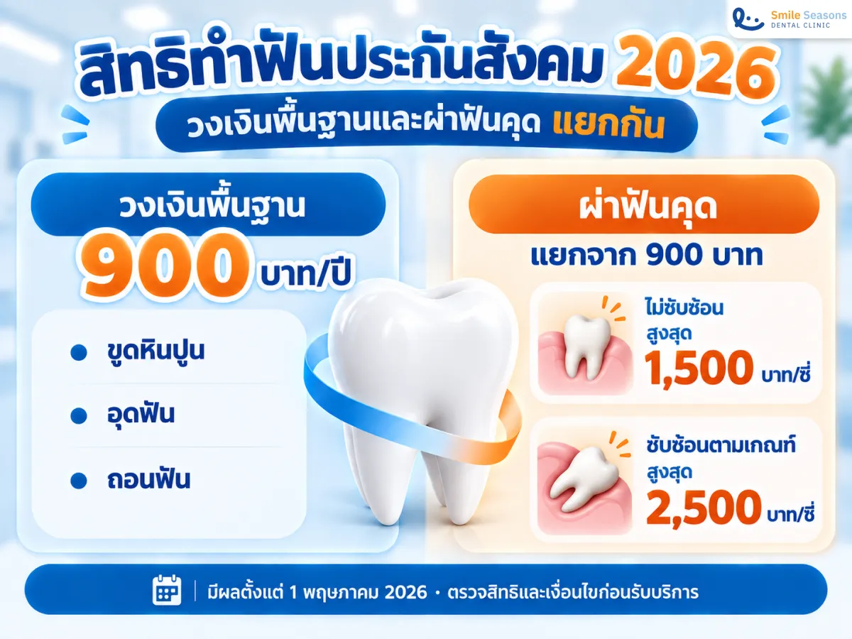 สิทธิทำฟันประกันสังคม 2026 ที่ Smile Seasons สำหรับขูดหินปูน อุดฟัน และถอนฟัน