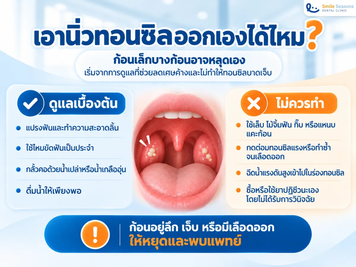วิธีดูแลนิ่วทอนซิลเบื้องต้นอย่างปลอดภัยและสิ่งที่ไม่ควรทำ