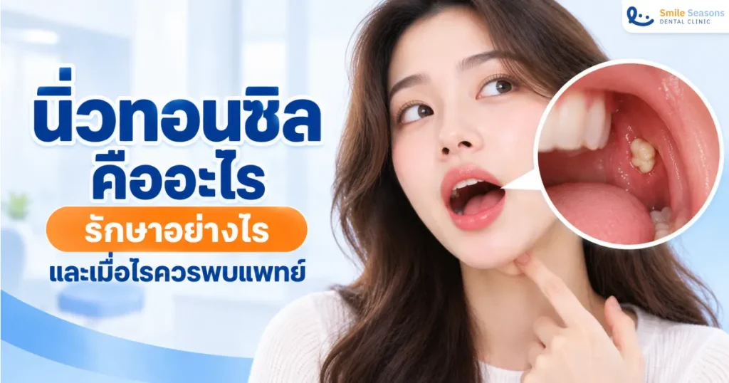 นิ่วทอนซิลคืออะไร รักษาอย่างไรและเมื่อไรควรพบแพทย์