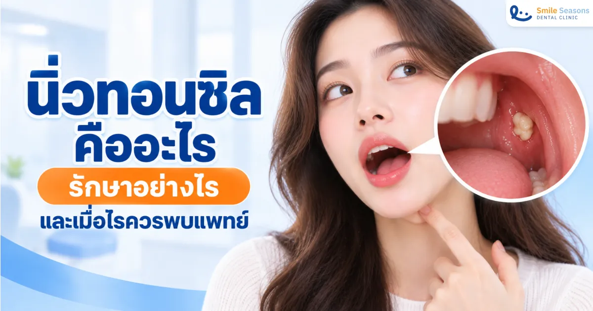 นิ่วทอนซิลคืออะไร รักษาอย่างไรและเมื่อไรควรพบแพทย์