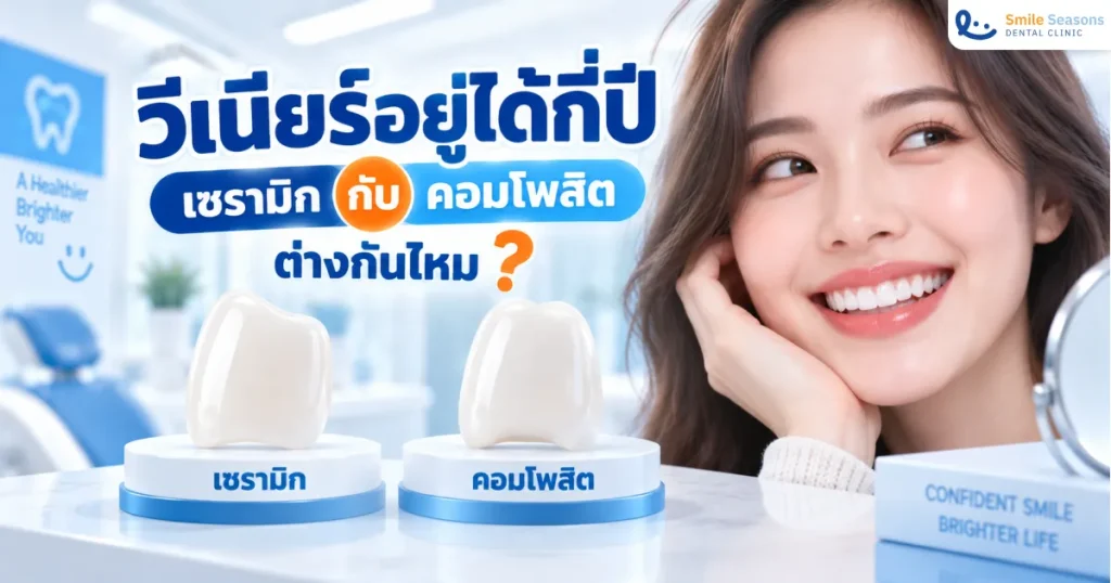 วีเนียร์อยู่ได้กี่ปี เซรามิกกับคอมโพสิตต่างกันไหม 2026