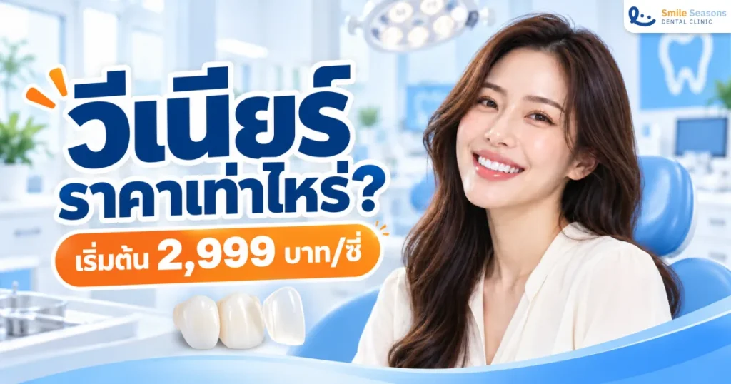 วีเนียร์ ราคาเท่าไหร่? เริ่มต้น 2,999 บาท/ซี่ อัปเดต 2569
