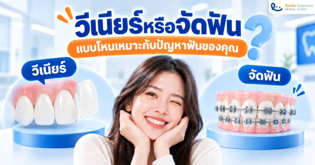 วีเนียร์หรือจัดฟัน แบบไหนเหมาะกับปัญหาฟันของคุณ 2026