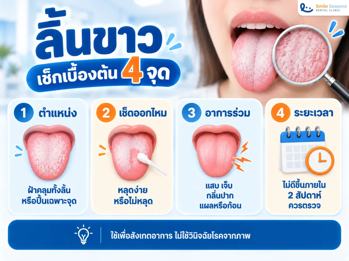 ตารางสังเกตลิ้นขาวจากตำแหน่ง การขูดออก อาการร่วม และระยะเวลา