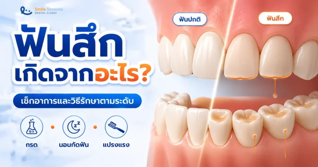 เปรียบเทียบฟันปกติกับฟันสึกจากกรด นอนกัดฟัน และการแปรงฟันแรง