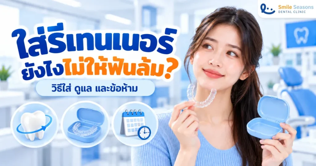 วิธีใส่รีเทนเนอร์ ดูแลอย่างไร ไม่ให้ฟันล้ม 2026