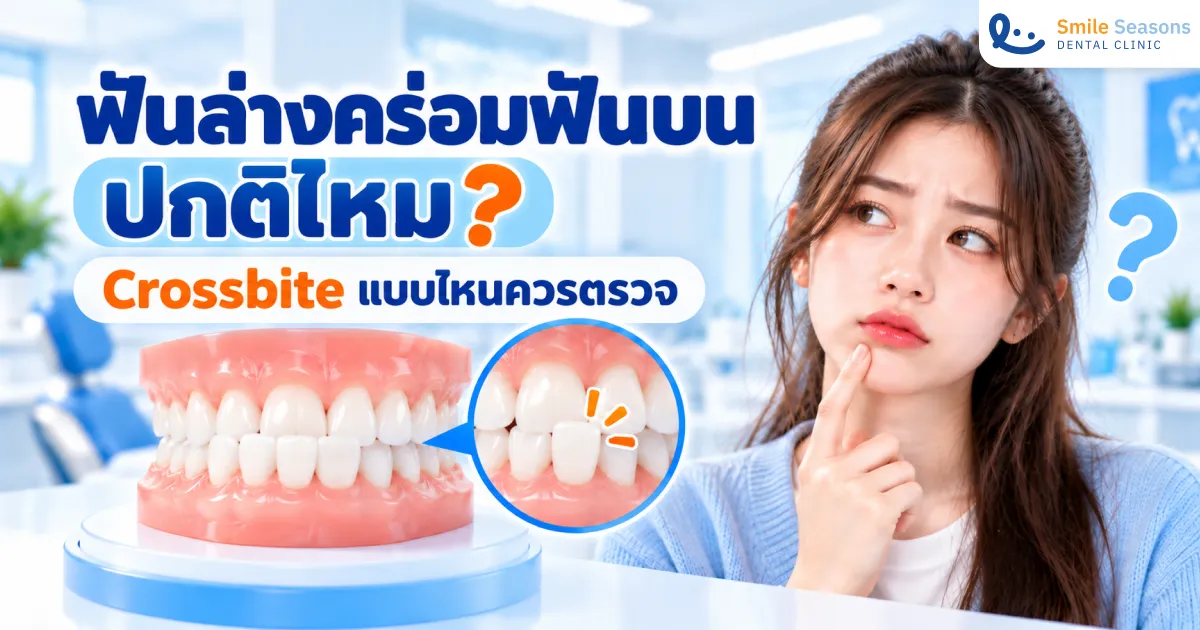 ฟันล่างคร่อมฟันบน ปกติไหม จัดฟันได้ไหม 2026