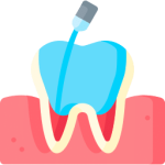 root canal treatment